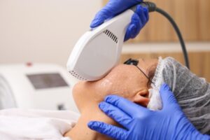 Giải quyết mọi vấn đề trên cơ thể bằng Công nghệ IPL - INTENSE PULSED LIGHT - Xu hướng điều trị mới bằng ánh sáng cường độ cao