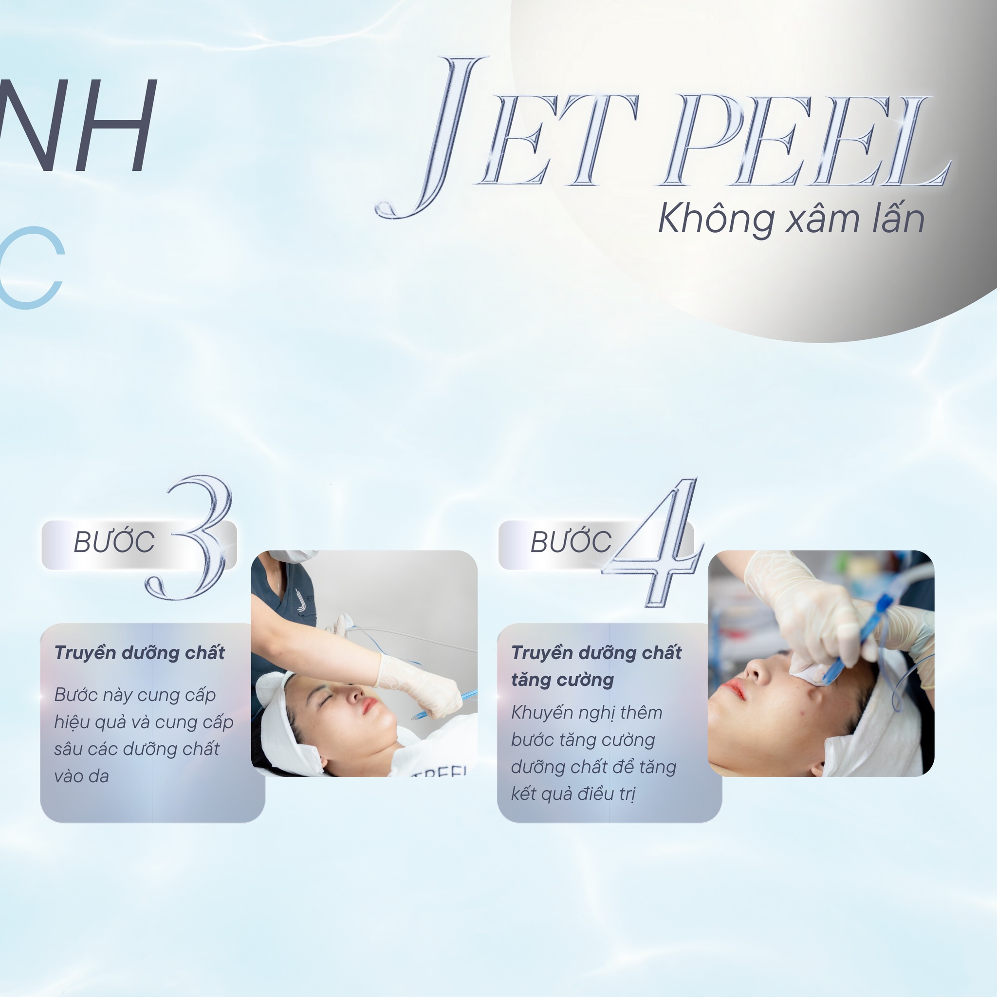 JetPeel không xâm lấn - Bí quyết cho làn da căng bóng với công nghệ Meso không kim