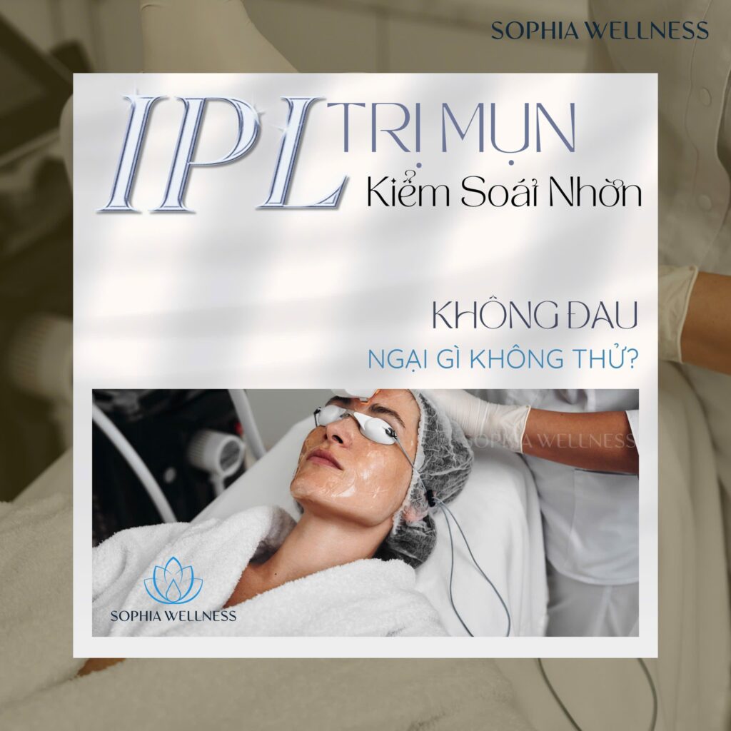 Điều trị mụn không xâm lấn cùng Công nghệ IPL – Không đau ngại gì không thử!