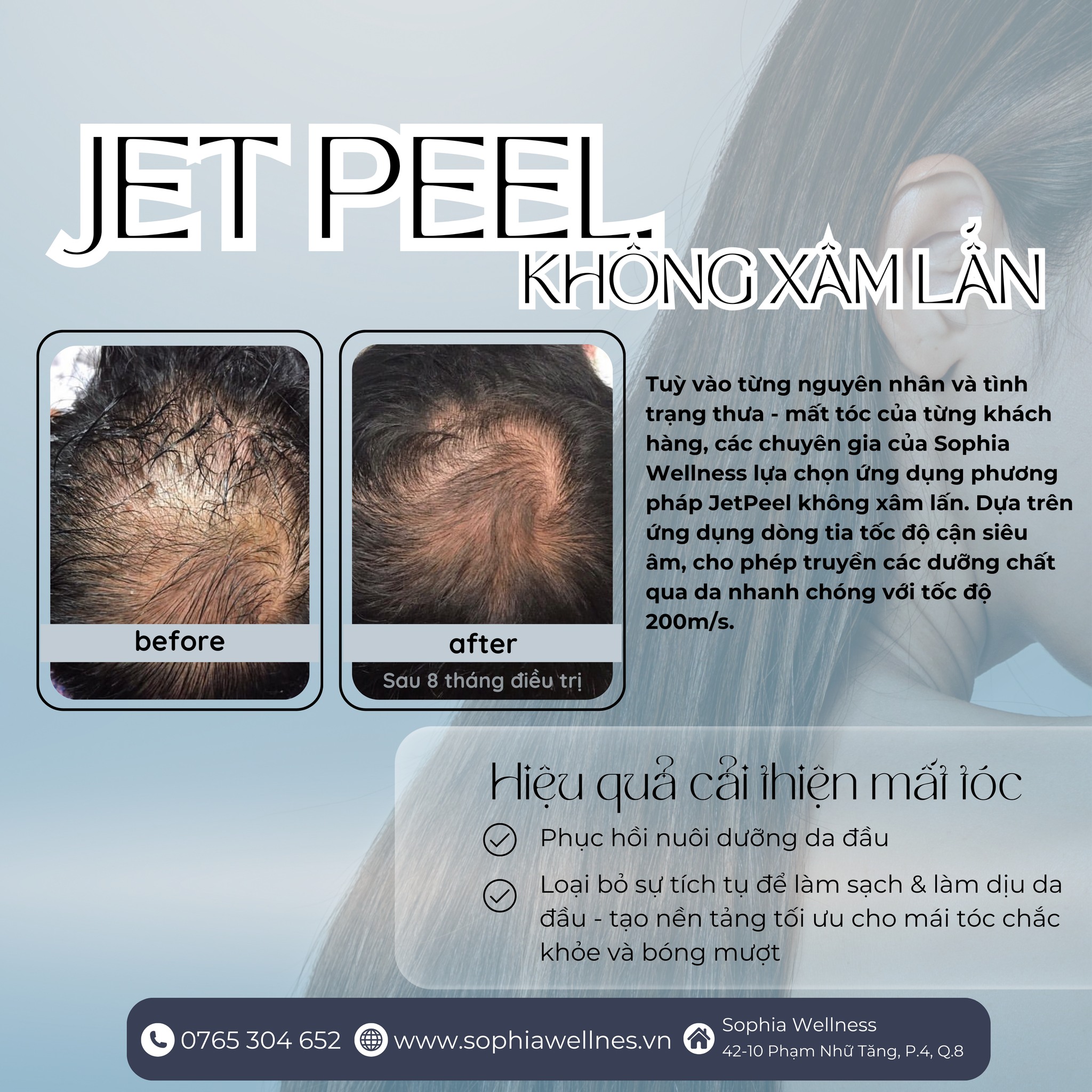 Hiệu quả cải thiện mái tóc từ liệu trình JETPEEL không xâm lấn kết hợp cùng bộ sản phẩm SELECTIVE CARE bậc nhất hiện nay