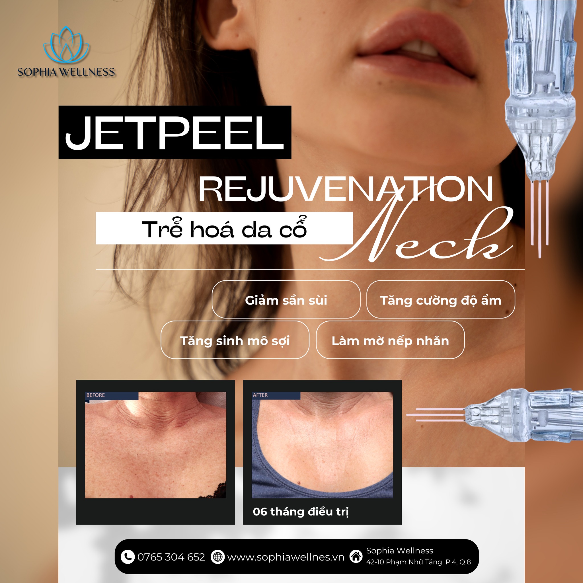 JETPEEL - Công nghệ chăm sóc da vùng cổ tối ưu