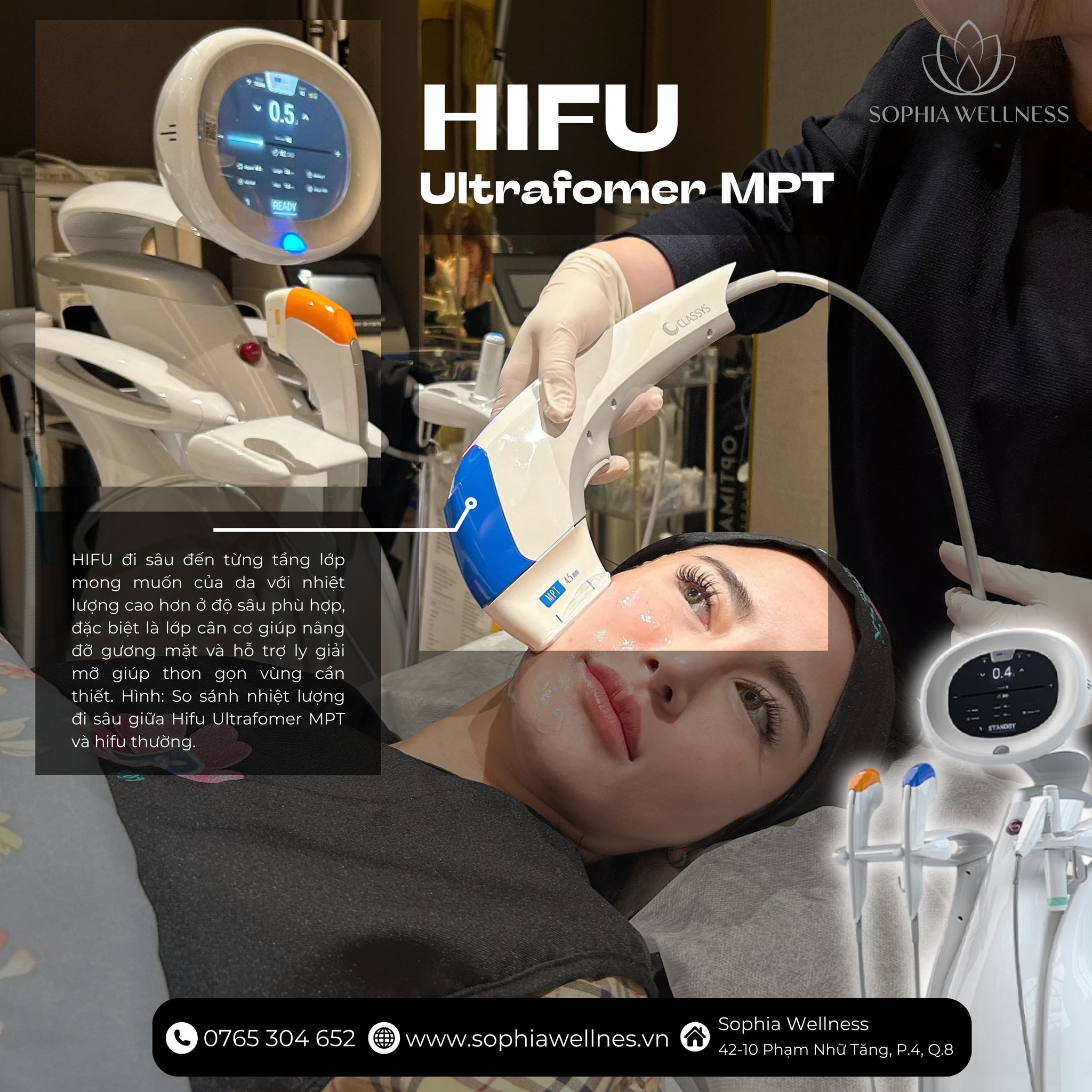 Tươi trẻ các đường nét trên khuôn mặt cùng Hifu Ultrafomer MPT - Công nghệ trẻ hoá da bậc nhất hiện nay
