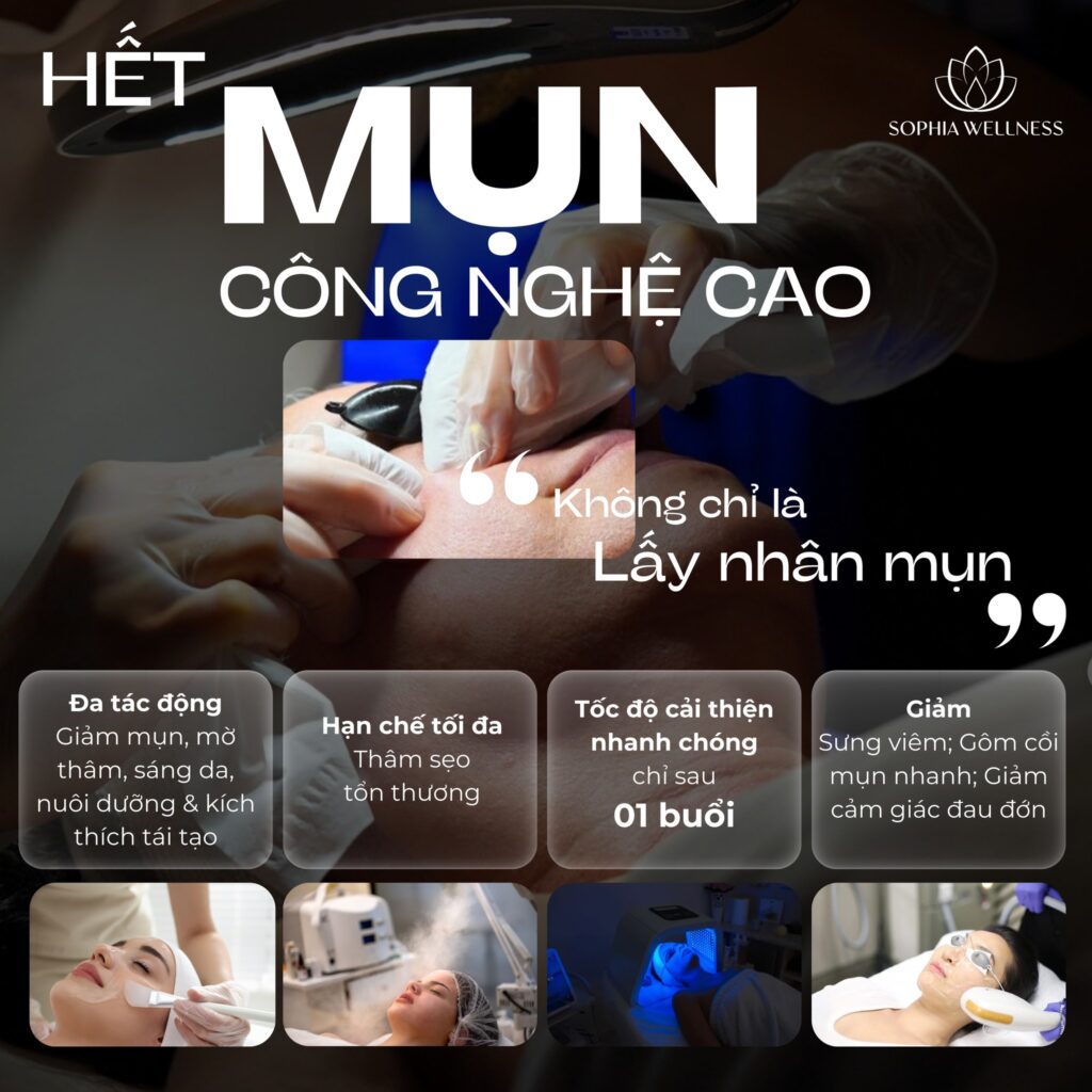 "Không chỉ đơn giản lấy nhân mụn là khỏi mụn" - Trải nghiệm 01 buổi điều trị mụn đa tác động tại Sophia Wellness