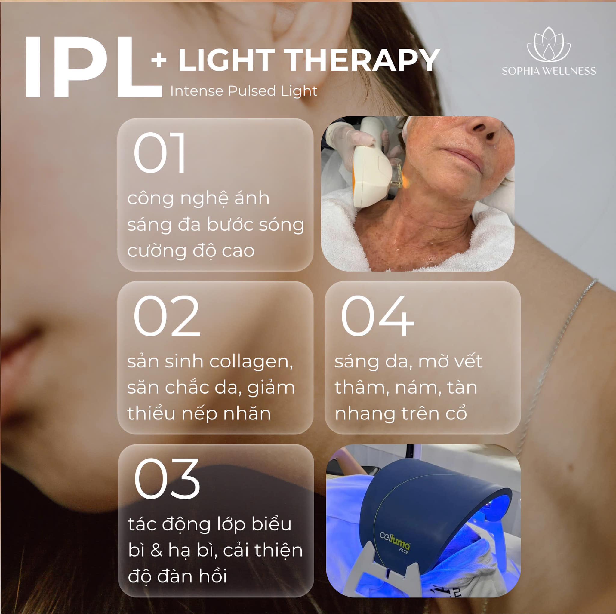 Trẻ hóa, ngăn ngừa & giảm dấu hiệu lão hóa vùng da cổ với công nghệ cao