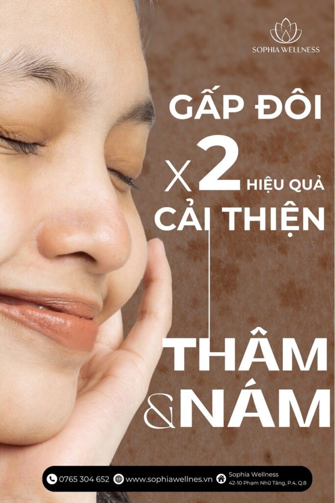 Gấp đôi hiệu quả cải thiện thâm & nám cùng phác đồ điều trị kết hợp Vitamin C & Tranexamic Axit