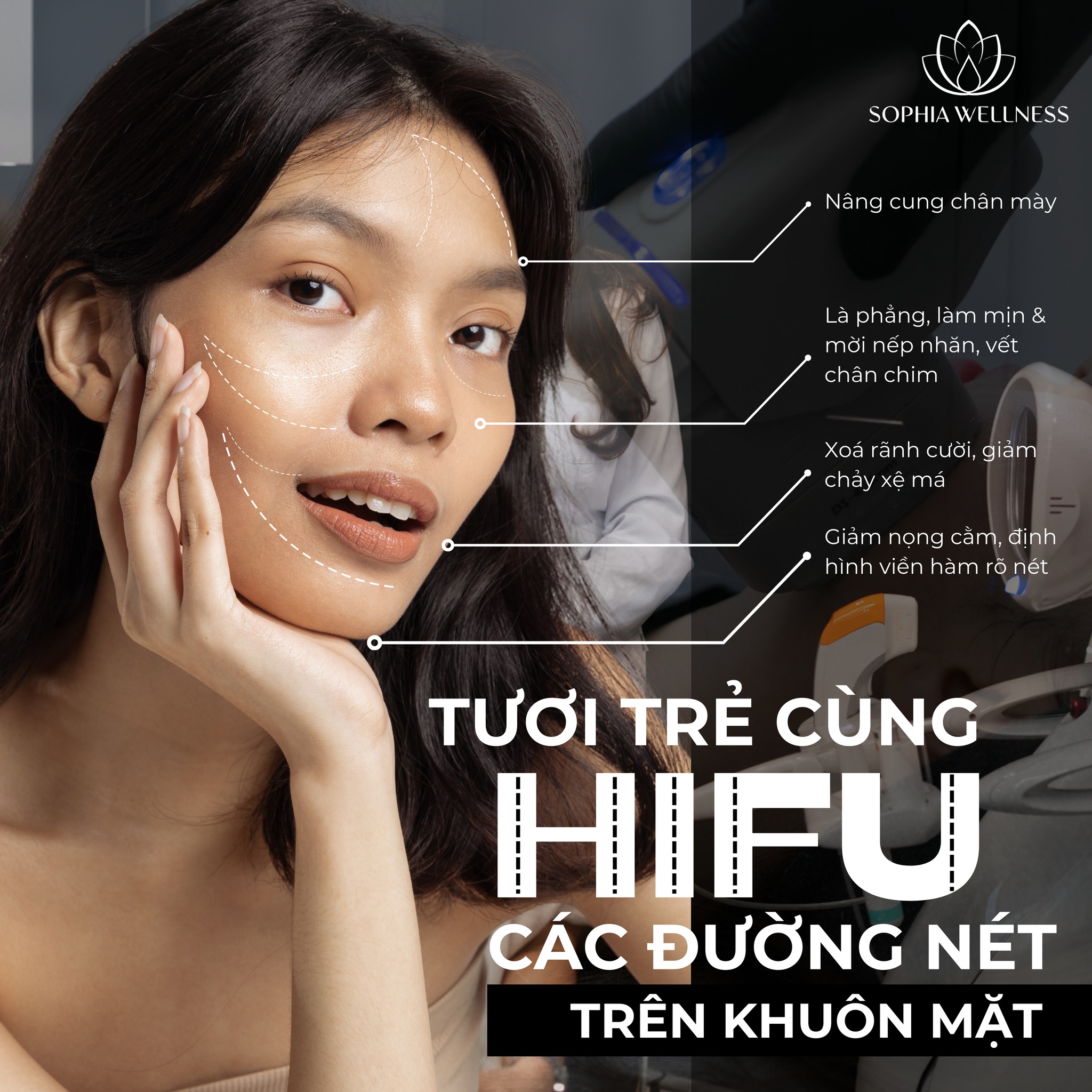 Tươi trẻ các đường nét trên khuôn mặt cùng Hifu Ultrafomer MPT - Công nghệ trẻ hoá da bậc nhất hiện nay