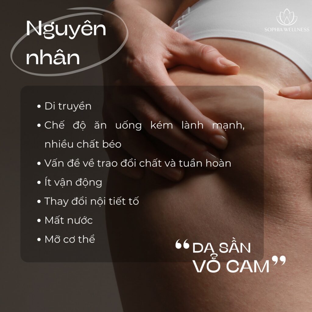 Da sần vỏ cam - Làm sao loại bỏ? Trải nghiệm liệu pháp công nghệ cao hàng đầu tại Sophia Wellness