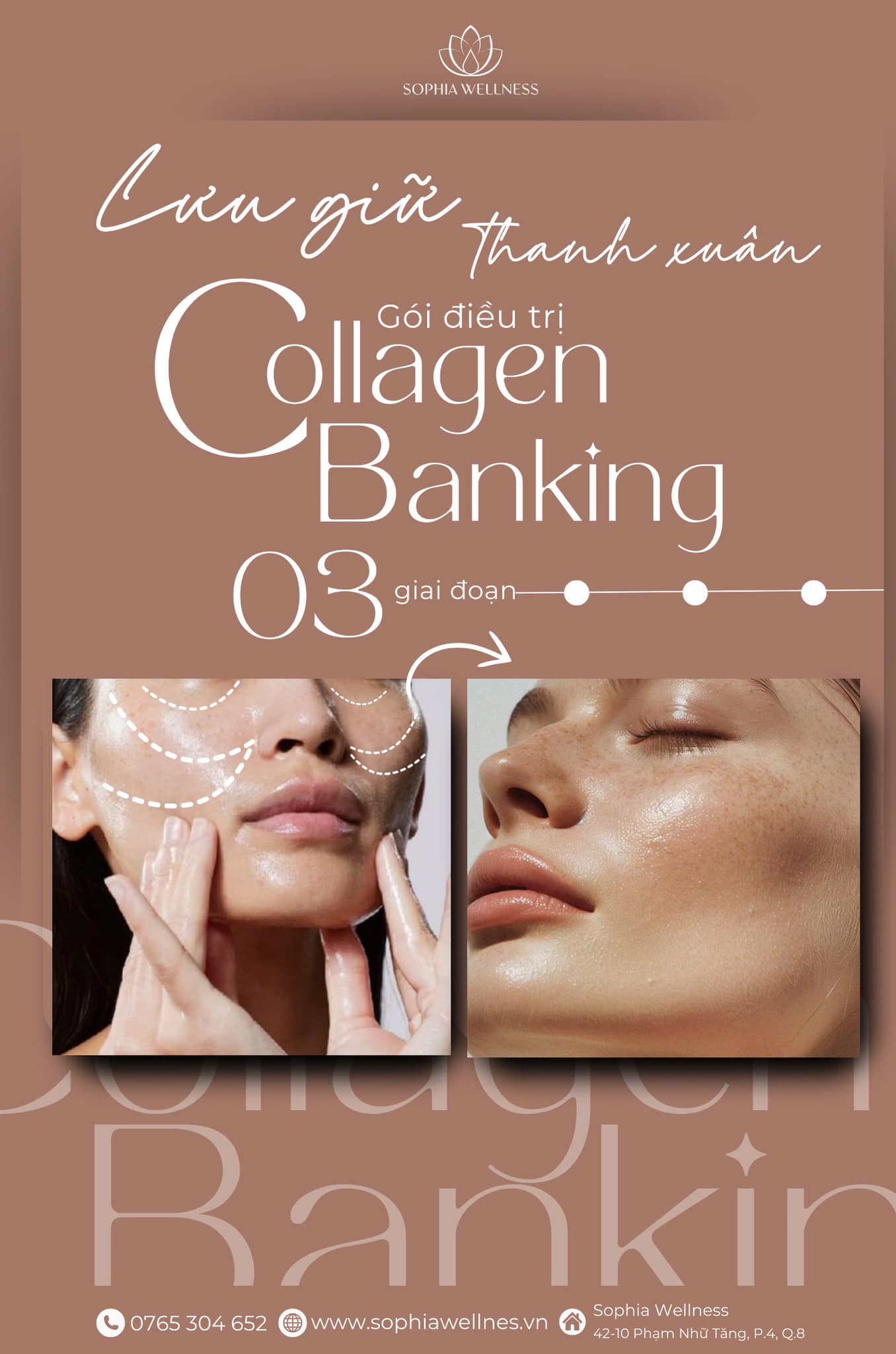 Lưu giữ thanh xuân với gói điều trị Collagen Banking - Chuẩn chỉnh 03 giai đoạn