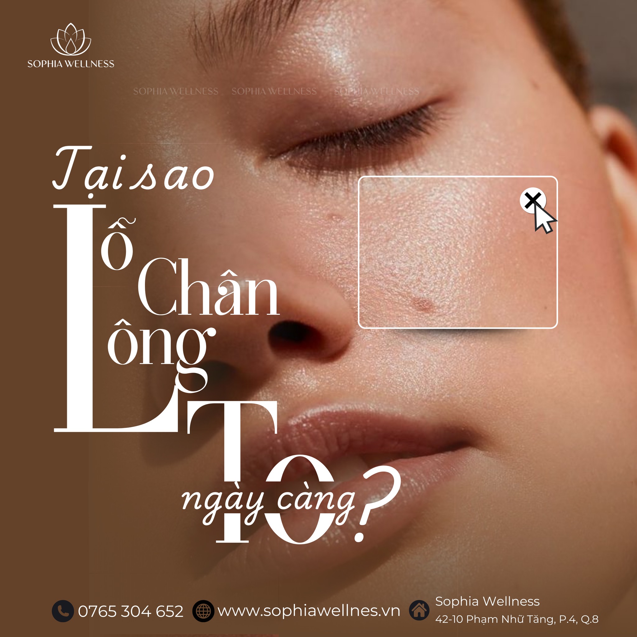 Khi lỗ chân lông "Mở tiệc", bí quyết "Khoá cửa" lỗ chân lông cho làn da mướt mát