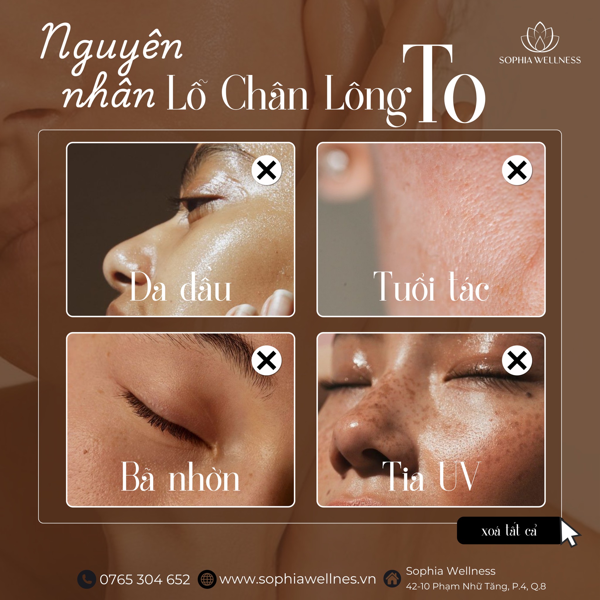 Khi lỗ chân lông "Mở tiệc", bí quyết "Khoá cửa" lỗ chân lông cho làn da mướt mát