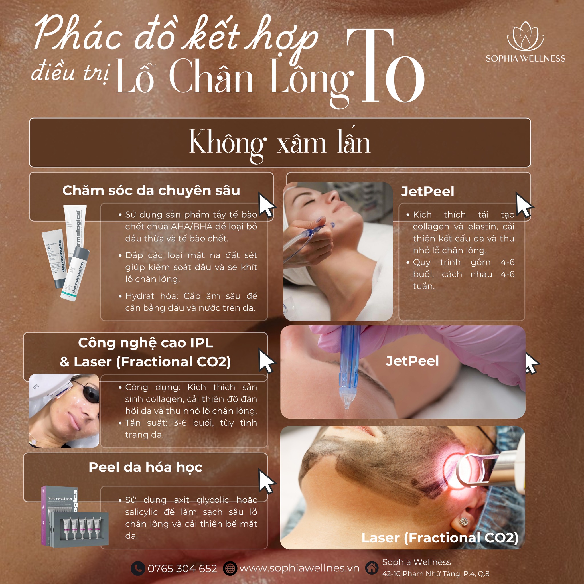 Khi lỗ chân lông "Mở tiệc", bí quyết "Khoá cửa" lỗ chân lông cho làn da mướt mát