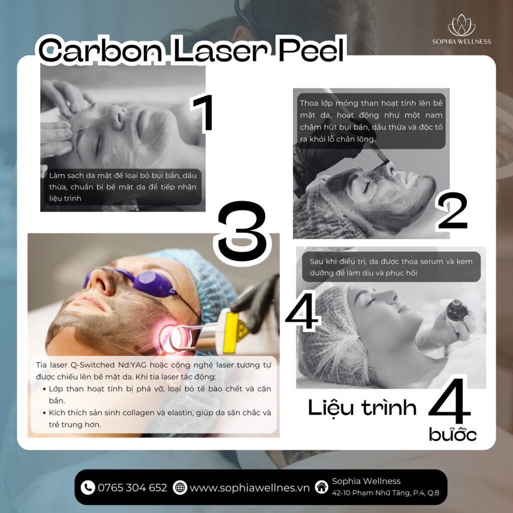 Rạng rỡ đón năm mới với liệu trình LASER CARBON PEEL