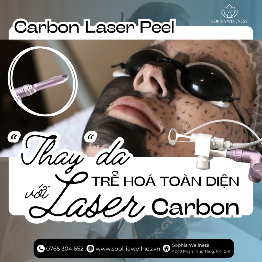 Rạng rỡ đón năm mới với liệu trình LASER CARBON PEEL