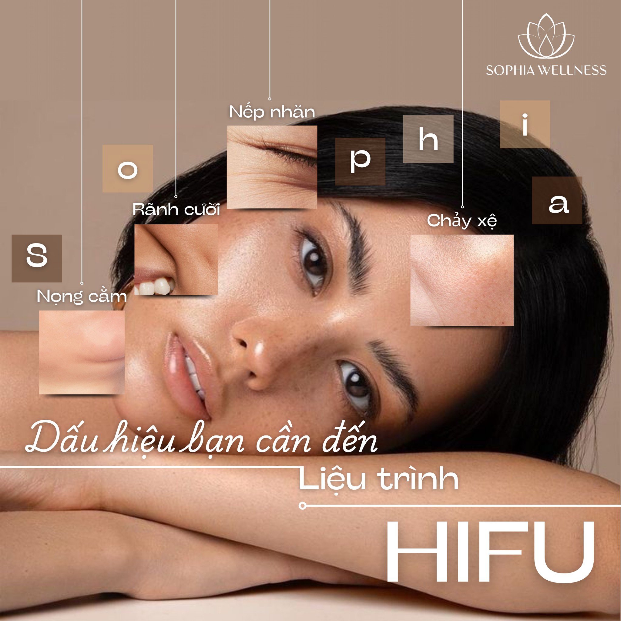 Dấu hiệu bạn cần đến liệu trình HIFU – Đừng để lão hóa làm phiền nụ cười của bạn!