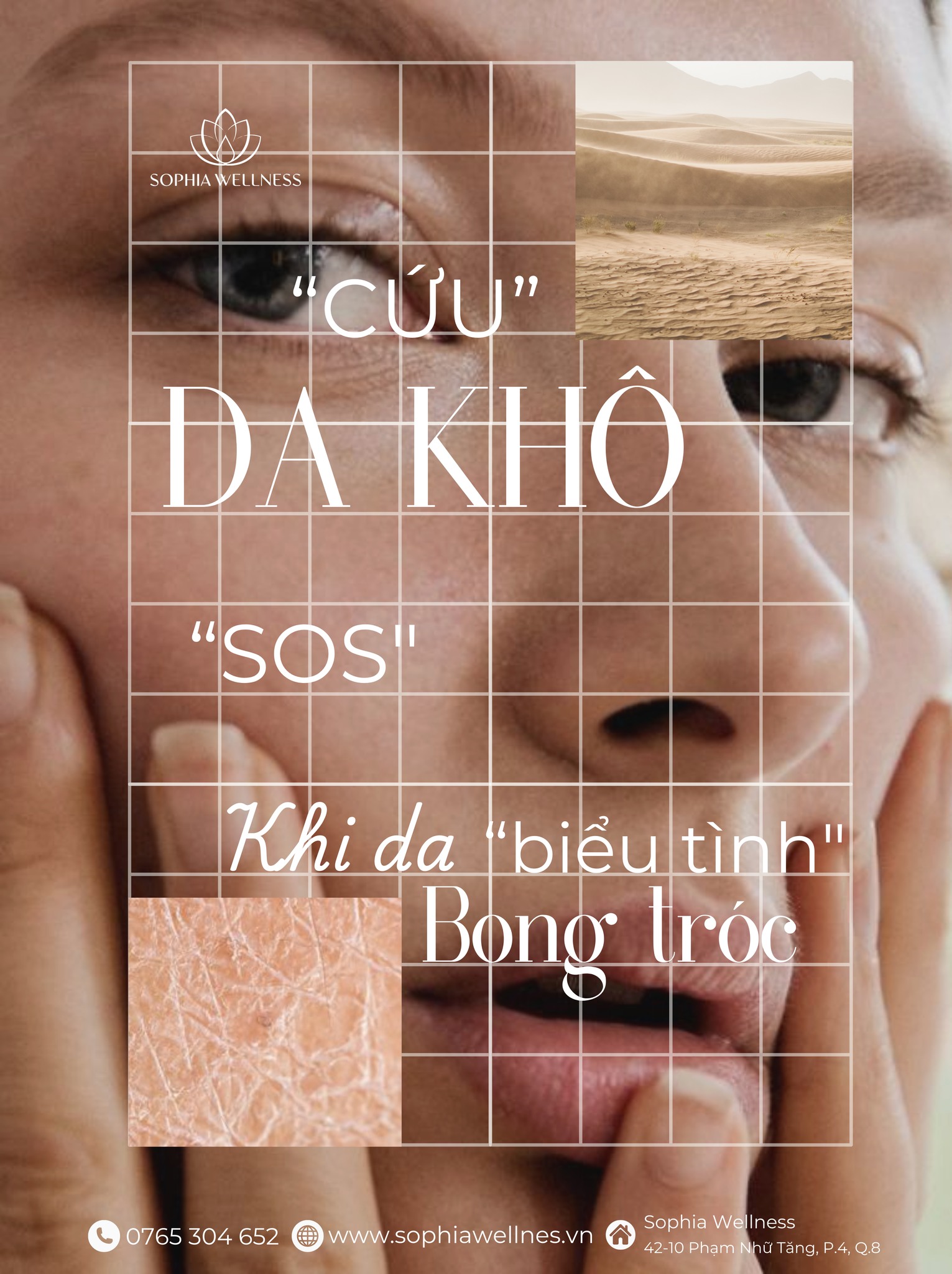 "Cứu" da khô trước tết cùng Sophia Wellness - Khi da khô biểu tình bong tróc