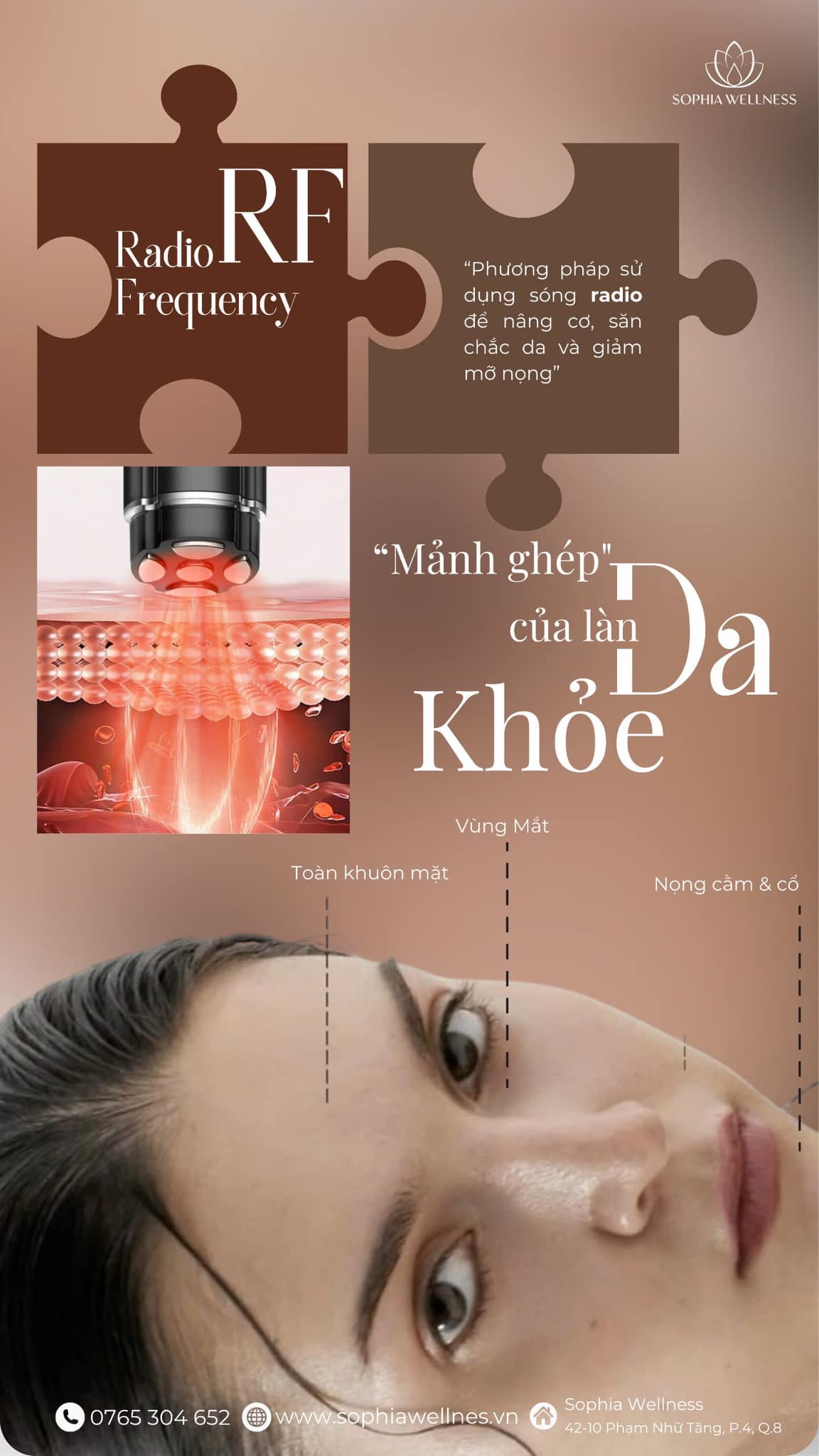 “Soi” Công Nghệ RF (Radio Frequency) - “Mảnh Ghép” Của Làn Da Khoẻ**