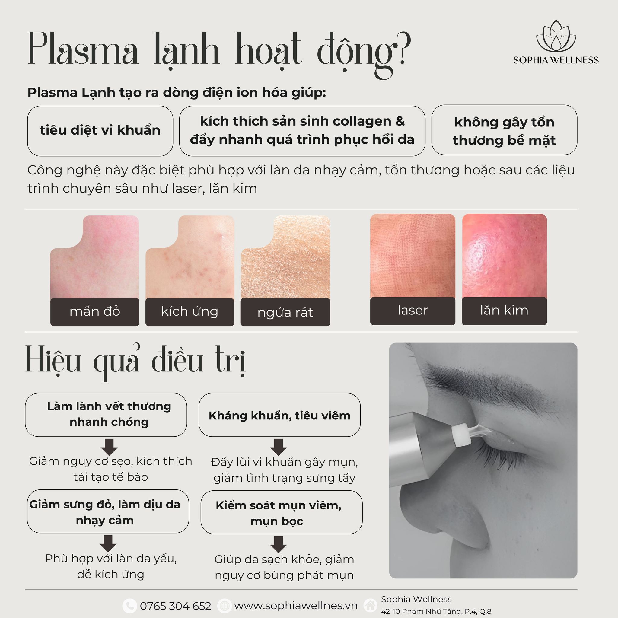 Plasma Lạnh - "Phép thuật" cấp cứu làn da kích ứng, nhạy cảm chỉ trong 30 phút