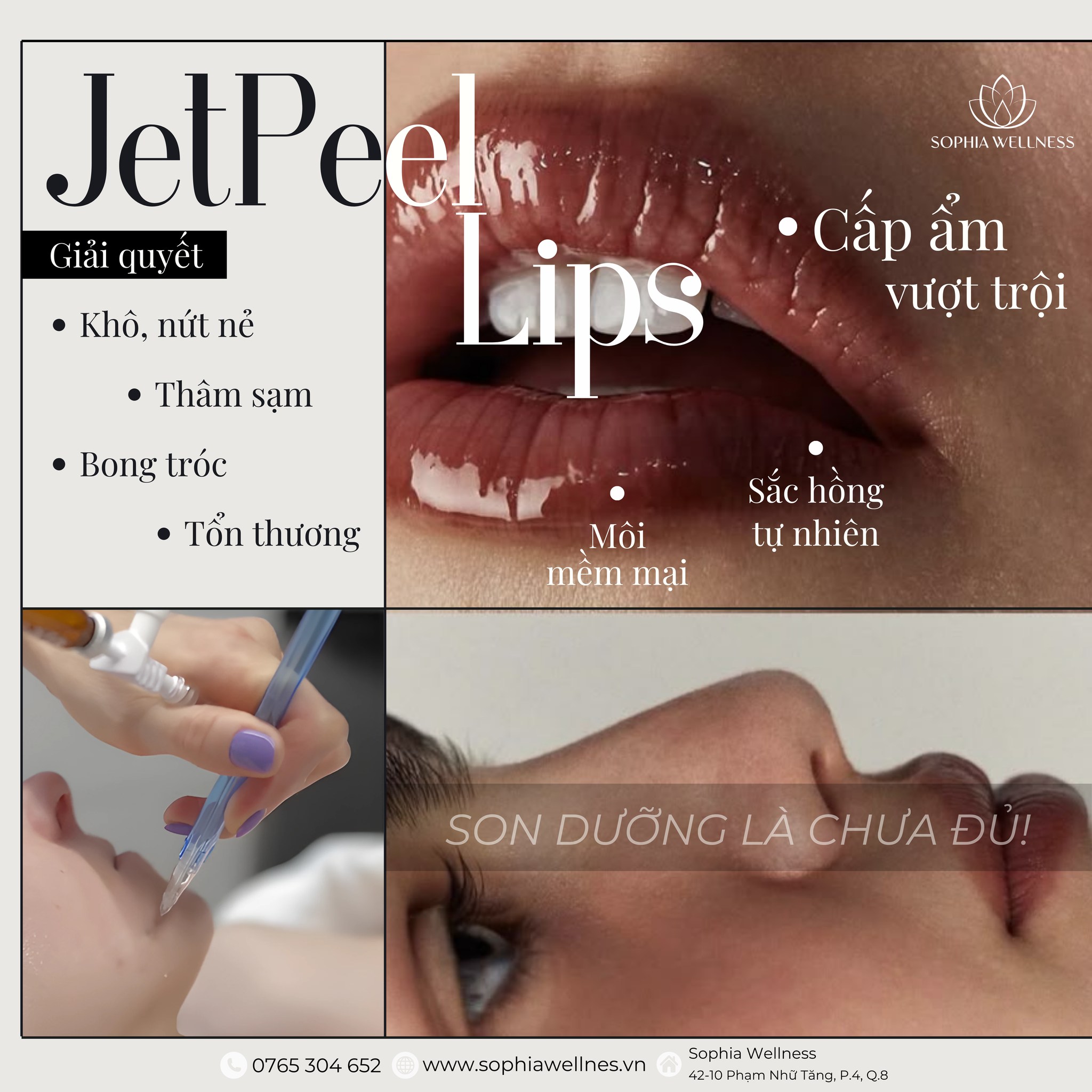 Son dưỡng là chưa đủ! Jetpeel – Đội quân "cấp ẩm" vượt trội cho đôi môi