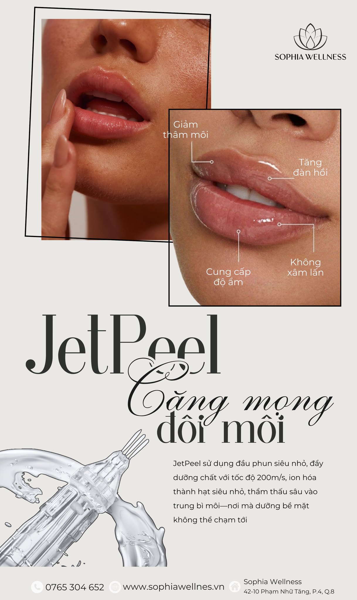 Không Filler nhưng môi vẫn căng mọng? "Check var" ngay công nghệ Jetpeel "làm mưa, làm gió" trong thẩm mỹ không xâm lấn
