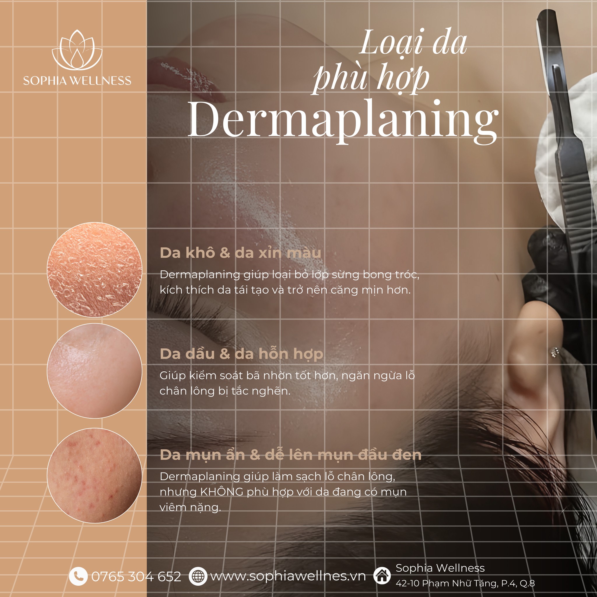 LÝ DO LÀN DA NÀO CŨNG "YÊU" DERMAPLANING