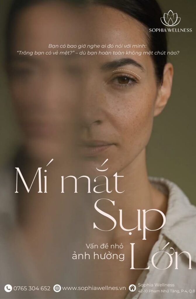 MÍ MẮT SỤP – VẤN ĐỀ NHỎ, ẢNH HƯỞNG LỚN