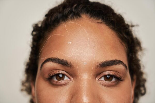 Phân tích da Face Mapping®