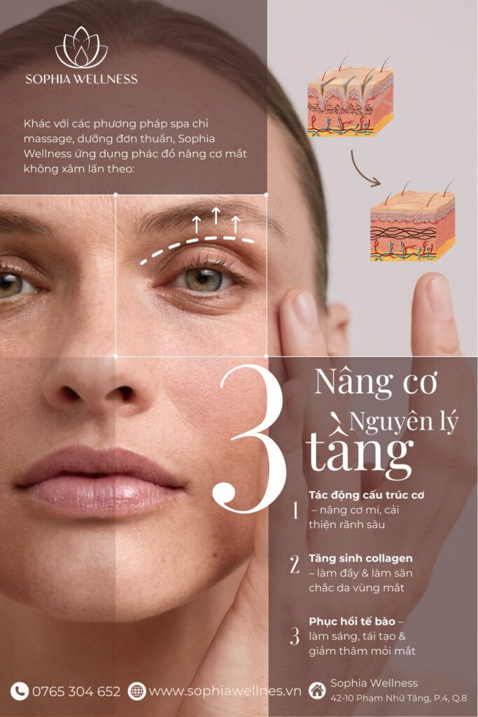 NÂNG CƠ NẾP MÍ KHÔNG XÂM LẤN - MÍ "SỤP" ĐỂ SOPHIA "ĐỠ" NHÉ!