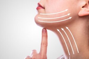 Cổ trước (Neck tightening) – 120 shot