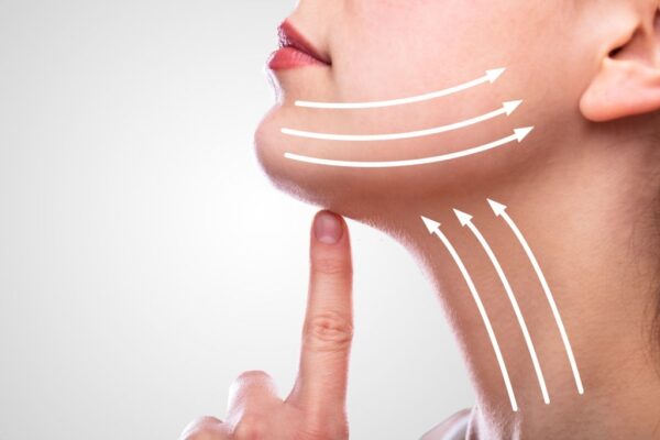 Cổ trước (Neck tightening) – 120 shot