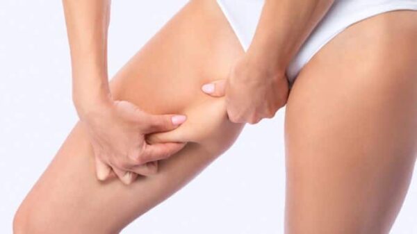 Đùi trong (Inner Thigh) – 400 shot