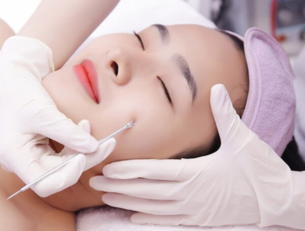 Làm sạch & lấy nhân mụn