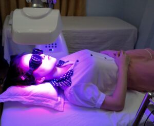 Ánh sáng dịu da mụn