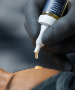 Alternative view of Exo Booster Microneedling